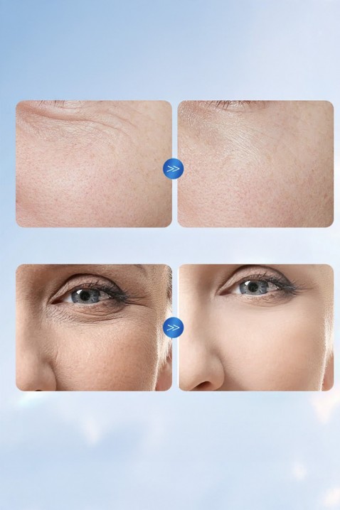Ampule za lice SADOER Hyaluronic AcidIVET.RS - Nova Kolekcija