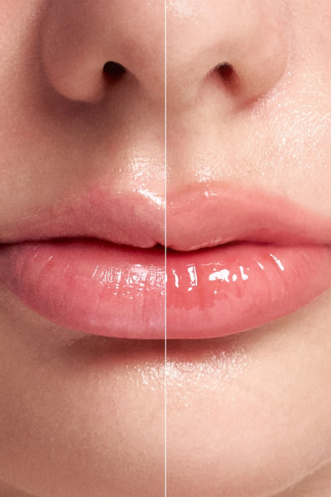 Intense lip plumper with microneedles Reedle Shot Lip Plumper Expert, 4,3 gIVET.RS - Nova Kolekcija