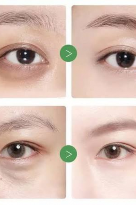 Mary&May Tranexamic Acid + Glutathion Eye Cream, 30 gIVET.RS - Nova Kolekcija